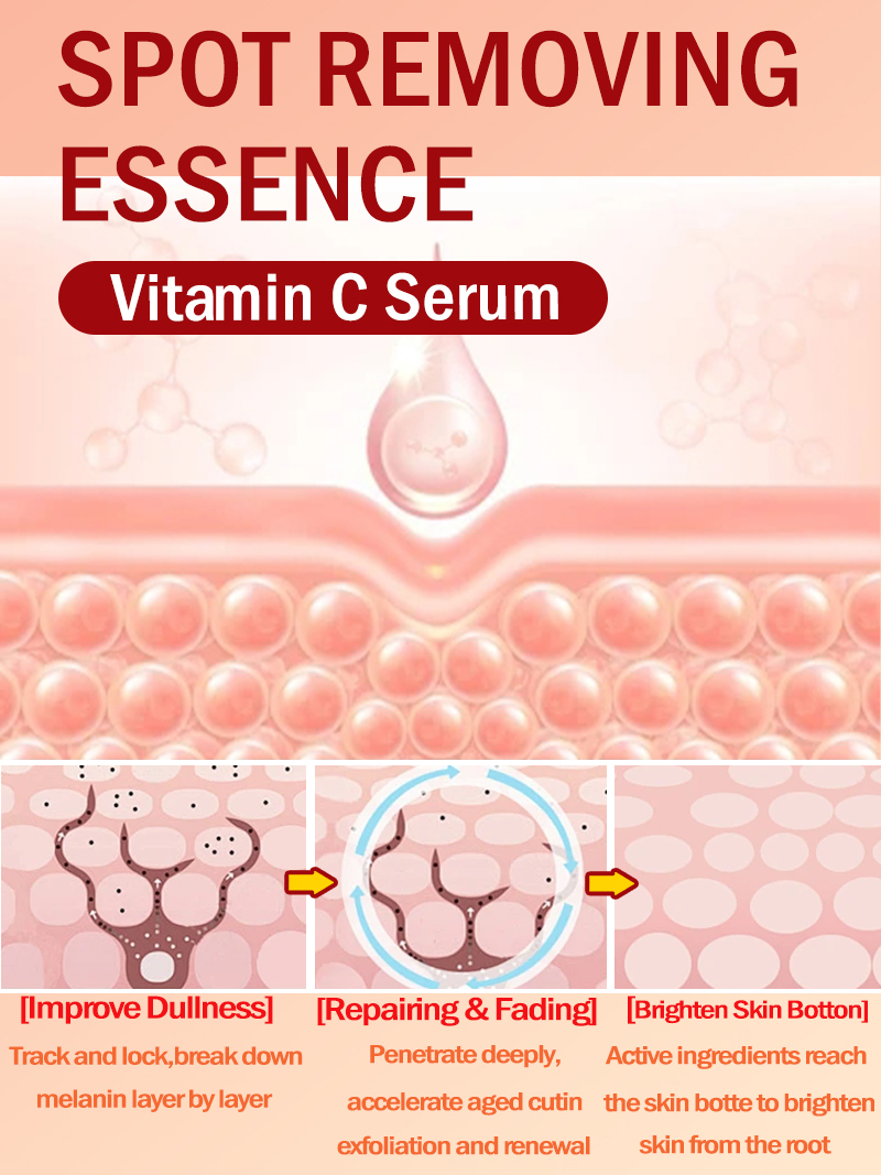 Lighten Freckles Melasma, Faci - Luxury Skincare Essence 评论和价格